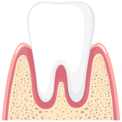 Strong tooth in gum on white background illustration